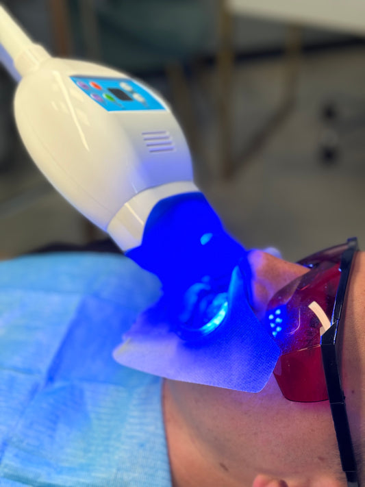 Lámpara LED Blanqueamiento Dental