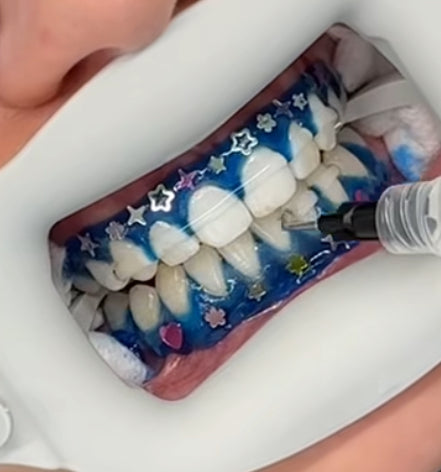 Decoración barrera gingival