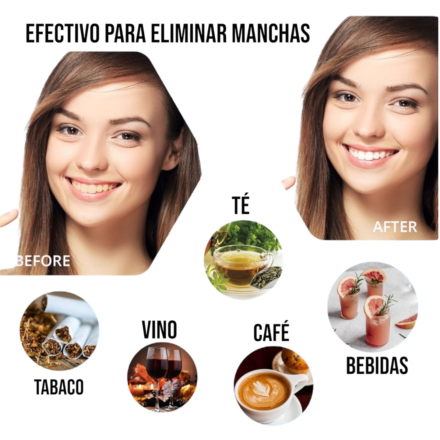 Kit Blanqueamiento Dental Cosmético Doméstico