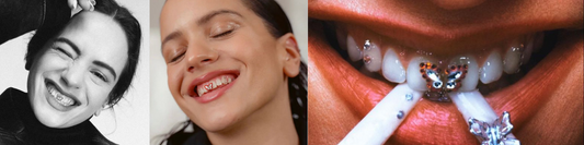 Mitos y Verdades sobre la Joyería Dental: Todo lo que debes saber