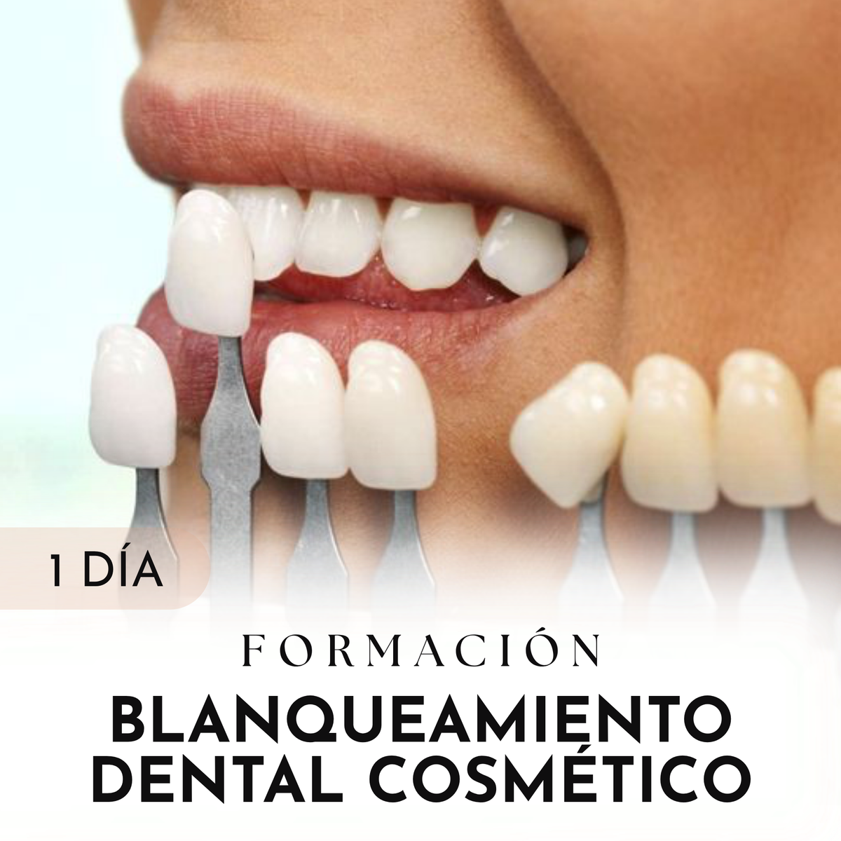Formación Presencial Blanqueamiento dental cosmético